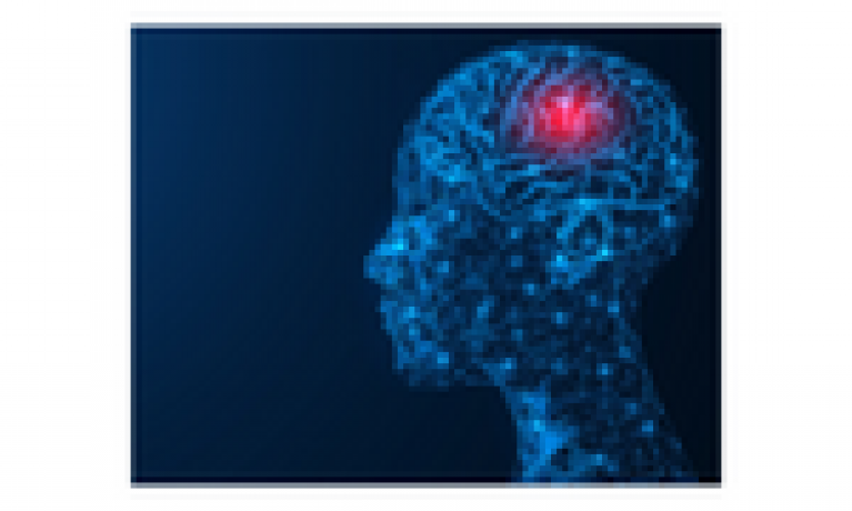 Deep Brain Stimulation (DBS) for Treatment Resistant Depression