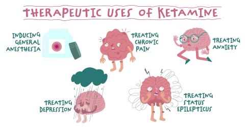 Ketamine: A Rising Star in Mental Health Treatment 