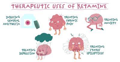 Ketamine: A Rising Star in Mental Health Treatment 